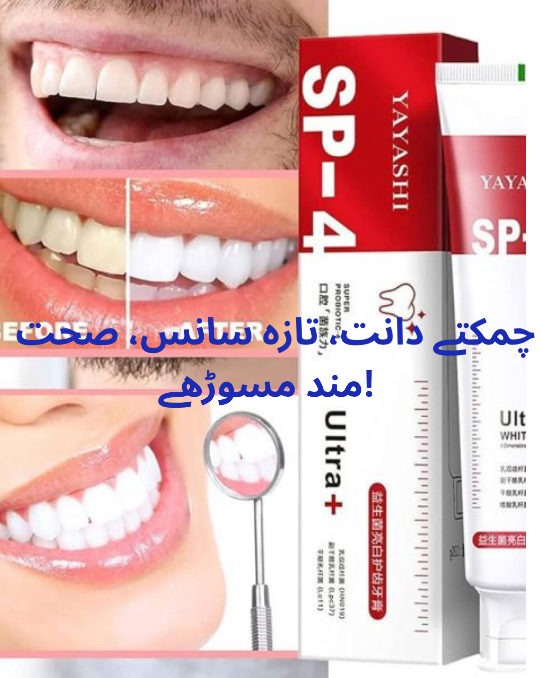 Yayashi Sp-4 Ultra Whitening Toothpaste Probiotic Stain Remover Stain Removing Toothpaste, Protects Gums Freshens Breath, For Everyone – 120 Gram