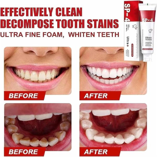 Yayashi Sp-4 Ultra Whitening Toothpaste Probiotic Stain Remover Stain Removing Toothpaste, Protects Gums Freshens Breath, For Everyone – 120 Gram